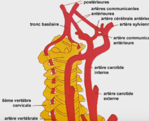 Chirurgie carotidienne