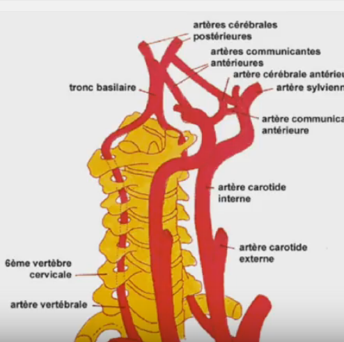 Chirurgie carotidienne